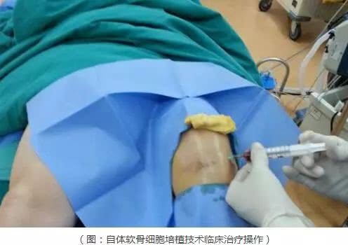 风湿类风湿检查主要查什么,哪家医院好.jpg 风湿类风湿检查主要查什么,哪家医院好.jpg