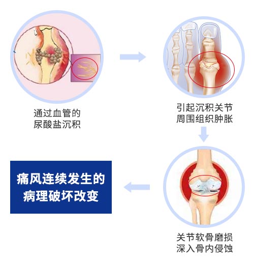 肌骨超声技术原理 什么是肌骨超声?郑州痛风风湿病医院为您讲解