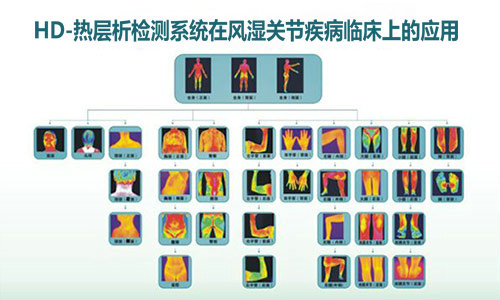 HD-热层析检测系统临床应用 HD—热层析检测系统适应症