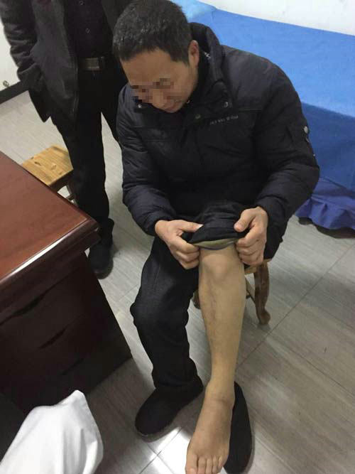 患者初次来院看诊,接受主治医生检查 科学疗法根源出发对症治疗痛风